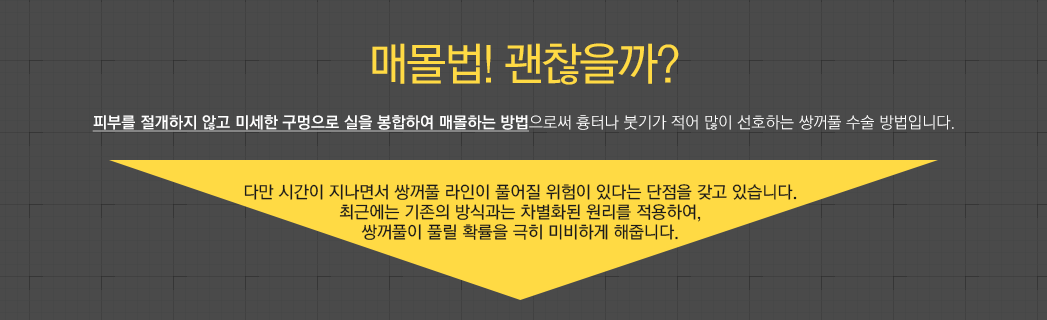 매몰법! 괜찮을까? 피부를 절개하지 않고 미세한 구멍으로 실을 봉합하여 매몰하는 방법으로써 흉터나 붓기가 적어 많이 선호하는 쌍꺼풀 수술 방법입니다. 다만 시간이 지나면서 쌍꺼풀 라인이 풀어질 위험이 있다는 단점을 갖고 있습니다. 최근에는 기존의 방식과는 차별화된 원리를 적용하여, 쌍꺼풀이 풀릴 확률을 극히 미비하게 해줍니다.