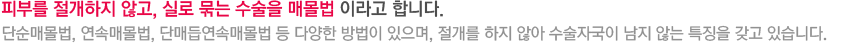 피부를 절개하지 않고, 실로 묶는 수술을 매몰법 이라고 합니다. 단순매몰법, 연속매몰법, 단매듭연속매몰법 등 다양한 방법이 있으며, 절개를 하지 않아 수술자국이 남지 않는 특징을 갖고 있습니다.