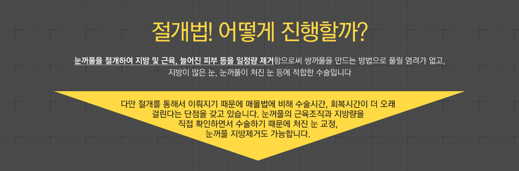 절개법! 어떻게 진행할까? 눈꺼풀을 절개하여 지방 및 근육, 늘어진 피부 등을 일정량 제거함으로써 쌍꺼풀을 만드는 방법으로 풀릴 염려가 없고, 지방이 많은 눈, 눈꺼풀이 처진 눈 등에 적합한 수술입니다. 다만 절개를 통해서 이뤄지기 때문에 매몰법에 비해 수술시간, 회복시간이 더 오래 걸린다는 단점을 갖고 있습니다. 눈꺼풀의 근육조직과 지방량을 직접 확인하면서 수술하기 때문에 처진 눈 교정, 눈꺼풀 지방제거도 가능합니다.