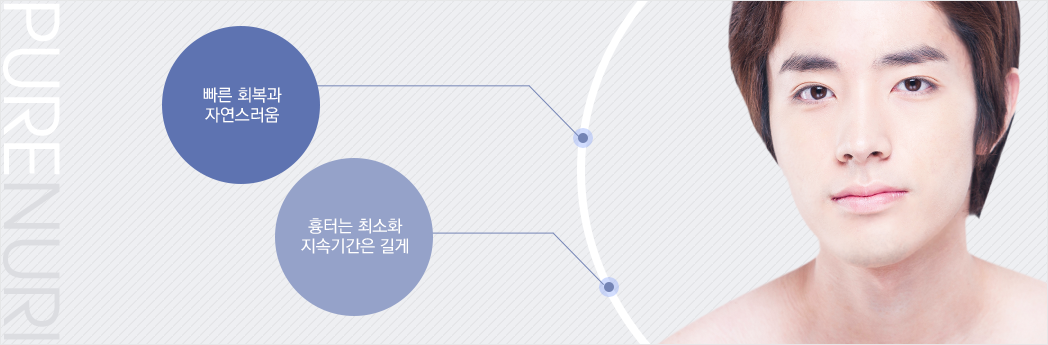 빠른 회복과 자연스러움, 흉터는 최소화 지속기간은 길게
