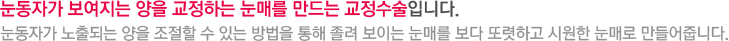 눈동자가 보여지는 양을 교정하는 눈매를 만드는 교정수술입니다. 눈동자가 노출되는 양을 조절할 수 있는 방법을 통해 졸려 보이는 눈매를 보다 또렷하고 시원한 눈매로 만들어줍니다.