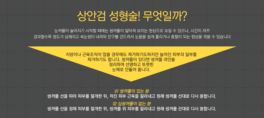 상안검 성형술! 무엇일까? 눈꺼풀이 늘어지기 시작할 때에는 쌍꺼풀이 얇아져 보이는 현상으로 보일 수 있으나, 시간이 자꾸 경과할수록 정도가 심해지고 속눈썹이 내려와 안구를 건드려서 눈물을 쉽게 흘리거나 충혈이 되는 현상을 겪을 수 있습니다. 지방이나 근육조직이 많을 경우에도 제거하기도하지만 늘어진 피부의 일부를 제거하기도 합니다. 쌍꺼풀이 있다면 쌍꺼풀 라인을 정리하여 선명하고 또렷한 눈매로 만들어 줍니다. 01 쌍꺼풀이 있는 분:쌍꺼풀 선을 따라 피부를 절개한 뒤, 처진 피부 근육을 잘라내고 원래 쌍꺼풀 선대로 다시 봉합니다. 02 심쌍꺼풀이 없는 분:쌍꺼풀 선을 정해 피부를 절개한 뒤, 쌍꺼풀 위 피부를 잘라내고 원래 쌍꺼풀 선대로 다시 봉합니다.