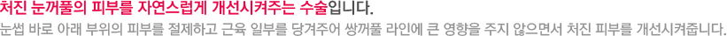 처진 눈꺼풀의 피부를 자연스럽게 개선시켜주는 수술입니다. 눈썹 바로 아래 부위의 피부를 절제하고 근육 일부를 당겨주어 쌍꺼풀 라인에 큰 영향을 주지 않으면서 처진 피부를 개선시켜줍니다.