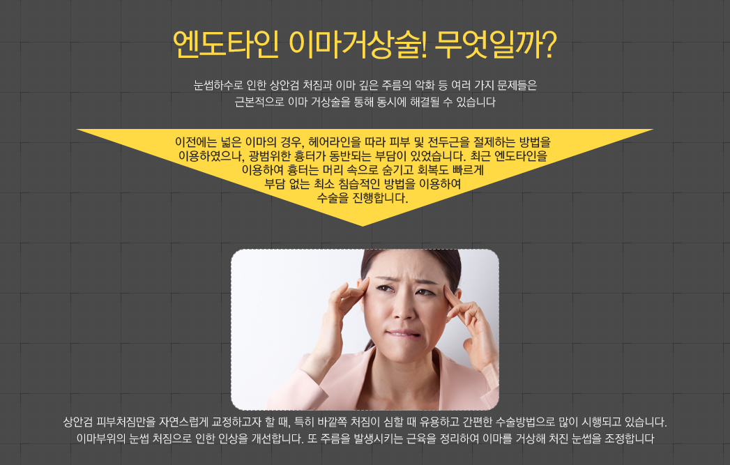 엔도타인 이마거상술! 무엇일까? 눈썹하수로 인한 상안검 처짐과 이마 깊은 주름의 악화 등 여러 가지 문제들은 근본적으로 이마 거상술을 통해 동시에 해결될 수 있습니다. 이전에는 넓은 이마의 경우, 헤어라인을 따라 피부 및 전두근을 절제하는 방법을 이용하였으나, 광범위한 흉터가 동반되는 부담이 있었습니다. 최근 엔도타인을 이용하여 흉터는 머리 속으로 숨기고 회복도 빠르게 부담 없는 최소 침습적인 방법을 이용하여 수술을 진행합니다. 상안검 피부처짐만을 자연스럽게 교정하고자 할 때, 특히 바깥쪽 처짐이 심할 때 유용하고 간편한 수술방법으로 많이 시행되고 있습니다. 이마부위의 눈썹 처짐으로 인한 인상을 개선합니다. 또 주름을 발생시키는 근육을 정리하여 이마를 거상해 처진 눈썹을 조정합니다.