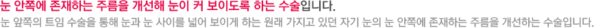눈 안쪽에 존재하는 주름을 개선해 눈이 커 보이도록 하는 수술입니다. 눈 앞쪽의 트임 수술을 통해 눈과 눈 사이를 넓어 보이게 하는 원래 가지고 있던 자기 눈의 눈 안쪽에 존재하는 주름을 개선하는 수술입니다.
