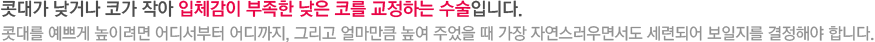 콧대가 낮거나 코가 작아 입체감이 부족한 낮은 코를 교정하는 수술입니다. 콧대를 예쁘게 높이려면 어디서부터 어디까지, 그리고 얼마만큼 높여 주었을 때 가장 자연스러우면서도 세련되어 보일지를 결정해야 합니다. 