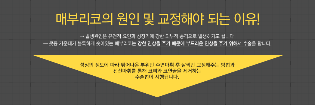매부리코의 원인 및 교정해야 되는 이유! → 발생원인은 유전적 요인과 성장기에 강한 외부적 충격으로 발생하기도 합니다. → 콧등 가운데가 볼록하게 솟아있는 매부리코는 강한 인상을 주기 때문에 부드러운 인상을 주기 위해서 수술을 합니다. - 성장의 정도에 따라 튀어나온 부위만 수면마취 후 살짝만 교정해주는 방법과 전신마취를 통해 코뼈와 코연골을 제거하는
수술법이 시행됩니다.