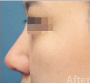 After