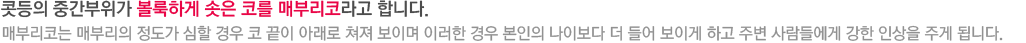 콧등의 중간부위가 볼록하게 솟은 코를 매부리코라고 합니다. 매부리코는 매부리의 정도가 심할 경우 코 끝이 아래로 쳐져 보이며 이러한 경우 본인의 나이보다 더 들어 보이게 하고 주변 사람들에게 강한 인상을 주게 됩니다.