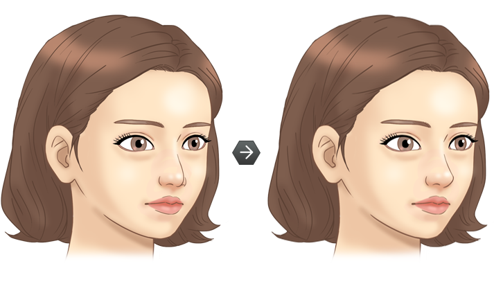 코끝코성형 전후모습 삽화
