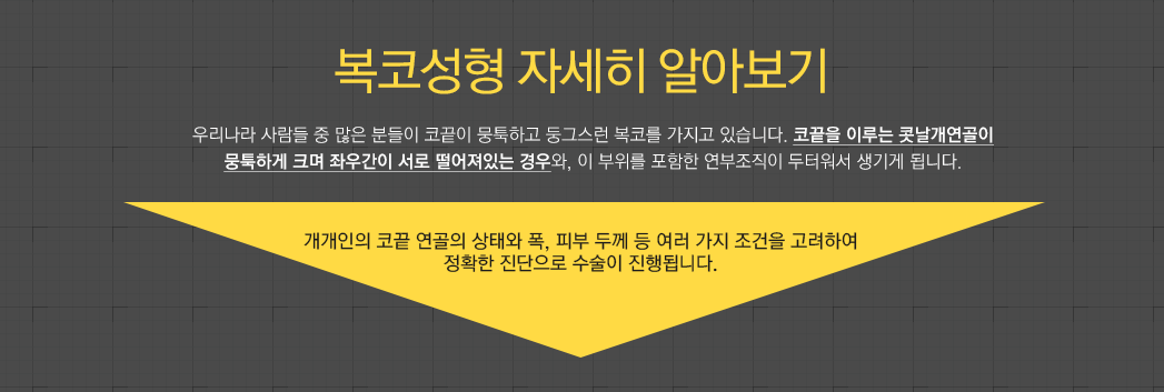 복코성형 자세히 알아보기 우리나라 사람들 중 많은 분들이 코끝이 뭉툭하고 둥그스런 복코를 가지고 있습니다. 코끝을 이루는 콧날개연골이
뭉툭하게 크며 좌우간이 서로 떨어져있는 경우와, 이 부위를 포함한 연부조직이 두터워서 생기게 됩니다. 개개인의 코끝 연골의 상태와 폭, 피부 두께 등 여러 가지 조건을 고려하여 정확한 진단으로 수술이 진행됩니다. 