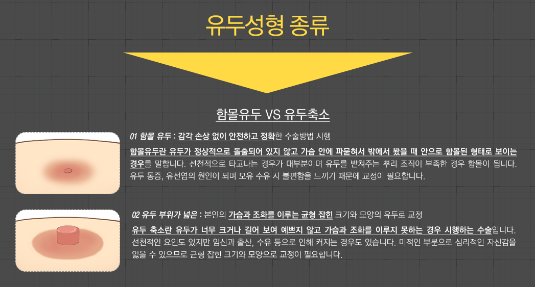 유두성형 종류 - 함몰유두 VS 유두축소 - 01 함몰 유두 : 감각 손상 없이 안전하고 정확한 수술방법 시행, 함몰유두란 유두가 정상적으로 돌출되어 있지 않고 가슴 안에 파묻혀서 밖에서 봤을 때 안으로 함몰된 형태로 보이는 경우를 말합니다. 선천적으로 타고나는 경우가 대부분이며 유두를 받쳐주는 뿌리 조직이 부족한 경우 함몰이 됩니다. 유두 통증, 유선염의 원인이 되며 모유 수유 시 불편함을 느끼기 때문에 교정이 필요합니다. 02 유두 부위가 넓은 : 본인의 가슴과 조화를 이루는 균형 잡힌 크기와 모양의 유두로 교정, 유두 축소란 유두가 너무 크거나 길어 보여 예쁘지 않고 가슴과 조화를 이루지 못하는 경우 시행하는 수술입니다. 선천적인 요인도 있지만 임신과 출산, 수유 등으로 인해 커지는 경우도 있습니다. 미적인 부분으로 심리적인 자신감을 잃을 수 있으므로 균형 잡힌 크기와 모양으로 교정이 필요합니다.